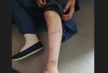 İBB Başkan Danışmanı Murat Ongun'un köpeği Hacer Demirlendi'ye dehşeti yaşatmıştı! Olaya ilişkin soruşturma başlatıldı