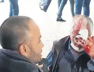 Erzurum Meydan Muhaberesi