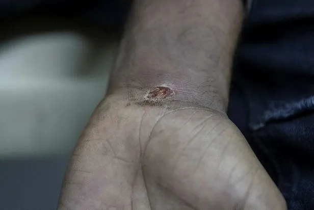 Yunan askerleri tarafından darp edilen mülteciler yaşadıklarını anlattı! "Ellerimde sigara söndürdüler"-2