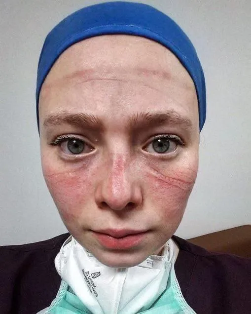seher-hemsireden-mesaj-var-maske-takmanin-ne-kadar-onemli-oldugunu-maalesef-hastaneye-dustukten-sonra-anliyorlar-1615146369189.jpg Seher hemşireden mesaj var: Maske takmanın ne kadar önemli olduğunu maalesef hastaneye düştükten sonra anlıyorlar-2