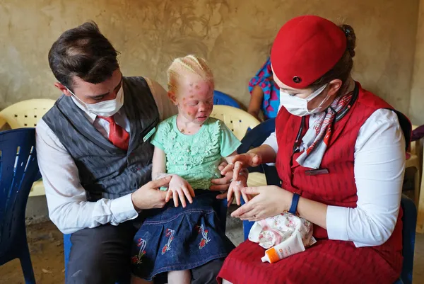 thy-afrikada-gunesten-saklanan-albino-hastasi-cocuklara-merhem-oldu-1634463986500.jpg THY Afrika'da güneşten saklanan albino hastası çocuklara merhem oldu-5