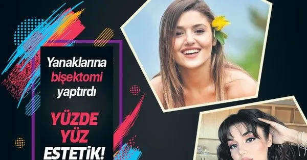 Hande Ercel In Yanaklarinin Sirri Ortaya Cikti Estetikteki Yeni Metotlara Basvurdu Bisektomi Ameliyati Oldu Takvim