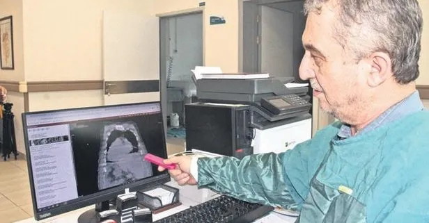 'Giresun sendromu' tıp literatürüne girdi