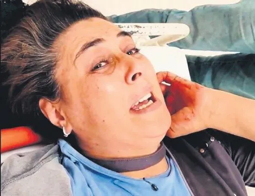 Eşini bıçakladı serbest kaldı!