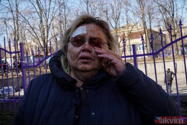 Yüzleri paramparça oldu! Kiev'de siviller bombalandı! - 9