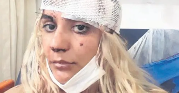 Kısmet Acar, dini nikahlı eşi tarafından defalarca darp edildi (Yaşam haberleri)