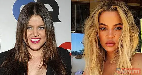 Bella Hadid ve Şeyma Subaşı'nın idolü Hailey Baldwin'in estetik açıklaması olay: Yüzüme asla dokunmadım! - 27