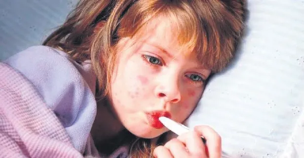 Uzmanlar uyardı! Çocuklarda yeni salgın: "Beşinci hastalık"