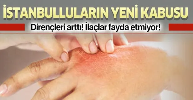 Sivrisinekler İstanbulluların kabusu oldu! Dirençleri arttı, ilaç fayda etmiyor