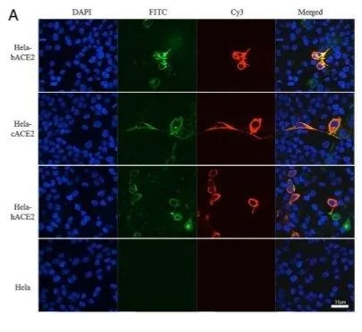 amerikan-mikrobiyoloji-derneginden-koronavirus-ile-ilgili-carpici-makale-2015te-bulunan-virus-kovid-19-muydu-1593109844115.jpeg