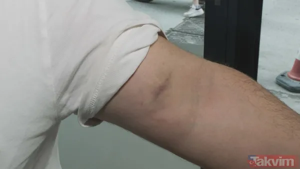 Eyüpsultan'da "yol verme" kavgası! Önce darbetti sonra tanımazlıktan geldi: Buyur kardeşim - 6