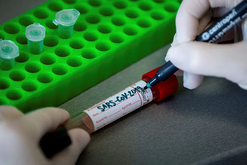 Bunu daha önce hiç duymadınız! İşte koronavirüsün yaşayamadığı tek yüzey! - 2