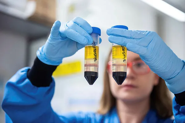 Astrazeneca - Oxford Üniversitesi koronavirüs aşısı hakkında şoke eden itiraf: Hata yaptık-4
