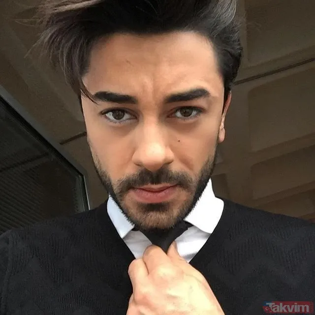 Gökhan Alkan�ın eski haline bakın! Gökhan Alkan�ın burnu estetik mi? 32