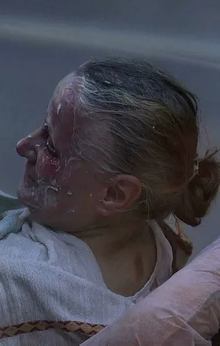 Bursa'da eşinin kulak kıllarını yakmak isteyen kadın eşini ve kendini yaktı