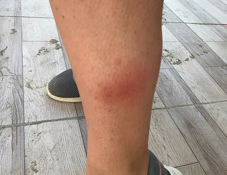 32 kişi hastanelik olmuştu! Nedeni belli oldu