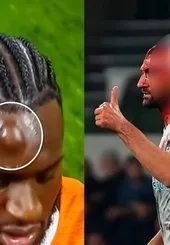 Başakşehir - Kocaelispor maçında talihsiz an!