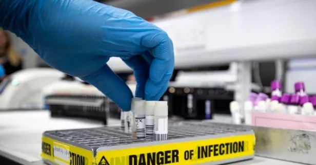 ABD'li sağlık uzmanı, koronavirüsün yarasadan değil, Çin'deki bir laboratuvardan çıktığını açıkladı