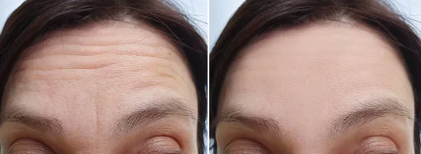 bu-besin-resmen-genclik-ilaci-her-gun-tuketen-en-az-10-yil-genclesiyor-sonuca-inanamayacaksiniz-1693420117622.jpg Her gün tüketen en az 10 yıl gençleşiyor! Sonuca inanamayacaksınız! Bu besin resmen gençlik ilacı!-6