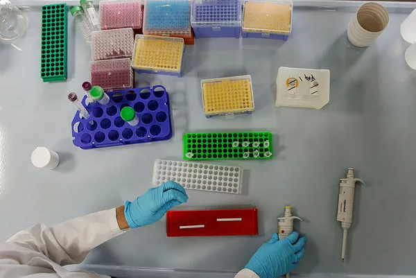 Koronavirüsün bir belirtisi daha ortaya çıktı! Eğer bunu yaşıyorsanız.... | Koronavirüs belirtileri nelerdir?-5