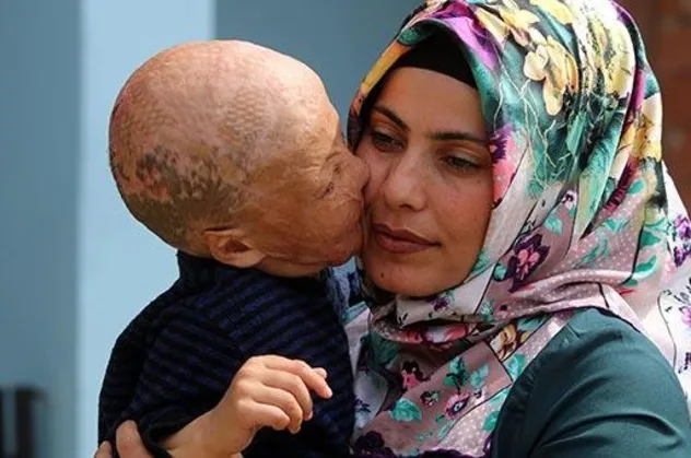 4 yaşındaki Halil Geyik'in ameliyatı için üç günde 200 bin lira!