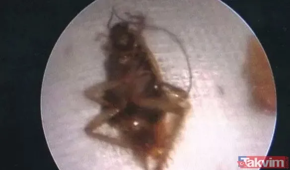 Midesine güvenenler baksın! Kulak ağrısıyla hastaneye giden adamın kulağından çıkanlar dünyayı şoke etti - 8