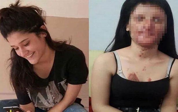 Berfin Özek kendisine asitle saldıran Casim Ozan Çeltik'le neden evlendi? Babası konuştu: Onaylamıyorum-7