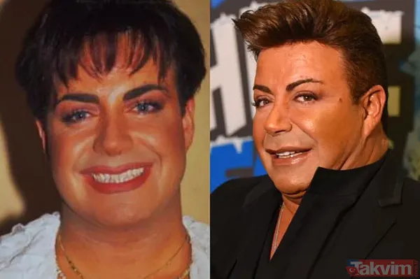 Şarkıcı Lara sonunda küçülttü! Estetikle bambaşka biri olan Lara paylaştı görenler 'yok artık' dedi - 46