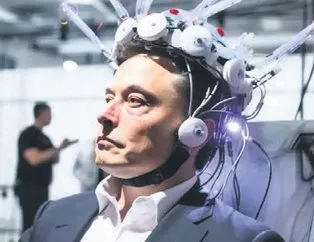 Elon ’beyin’ gördüğü!
