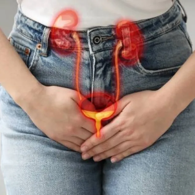 İdrarda kan mesanede kanser