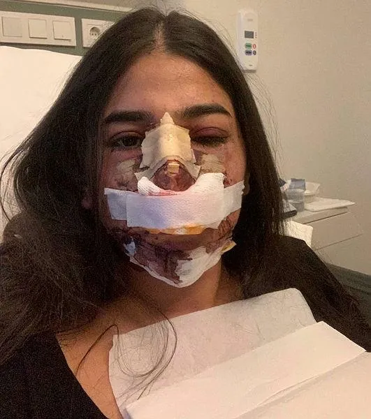 Son dakika: Ünlü estetisyen Op. Dr. Bilgehan Aydın'dan skandal olay! Burun operasyonu için kulağını kesti: Psikolojisi bozuldu-5