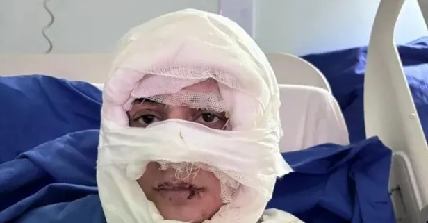 Eğlence mekanında korkunç saldırı: Yüzüne kolonya dökülüp ateşe verildi | O cani tutuklandı