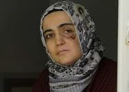 Hem tedaviyi kabul etmedi hem de algı operasyonuna soyundu! FETÖcü Ayşe Özdoğanın tezgahı çöktü