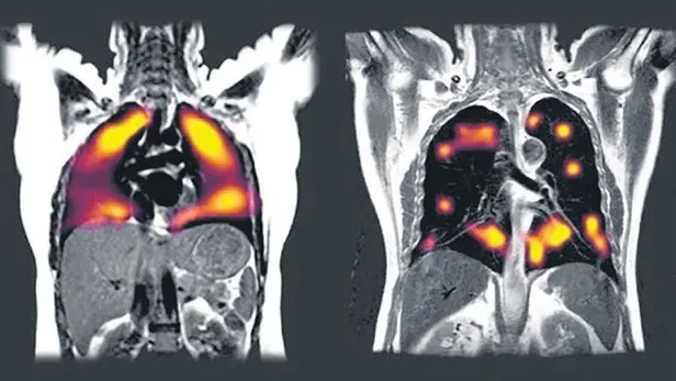 Çağla Kubat’ın ortağı Talat Aşıkoğlu koronavirüsten hayatını kaybetti | Yurttan ve dünyadan Kovid-19 haberleri-6