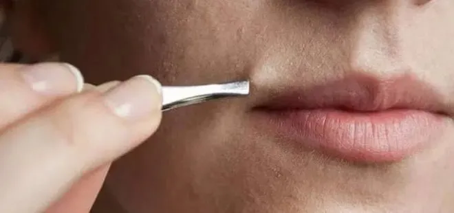 1-tanesi-bile-tek-seanslik-buz-lazer-etkisinde-kil-kokunu-kurutan-dogal-cozum-bulundu-1715867002970.jpeg Kıl kökünü kurutan doğal çözüm bulundu! 1 tanesi bile tek seanslık buz lazer etkisinde-3