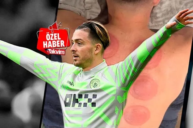 İngiliz Jack Grealish de hacamat kervanına katıldı!