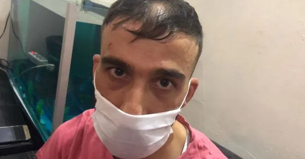 Bahçelievler’de darbedilen Suriyeli Muhammed Selmo o anları anlattı! "Öleceğimi zannettim"