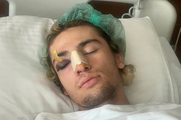 Milli sporcuya öldüresiye dayak! Kaykayla suratına vurdular