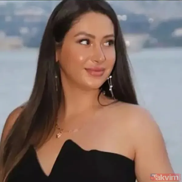 28 yaşındaki fenomen Neşe Özkan’dan acı haber! Estetik ameliyatı sonrası hayatını kaybetti - 2