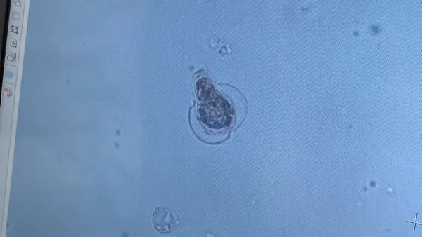 musilaj-neden-olur-istanbul-universitesi-ilk-incelemesini-tamamladi-carpici-pandemi-etkisi-1623135216972.jpg Müsilaj neden olur? İstanbul Üniversitesi ilk incelemesini tamamladı! Çarpıcı pandemi etkisi-5