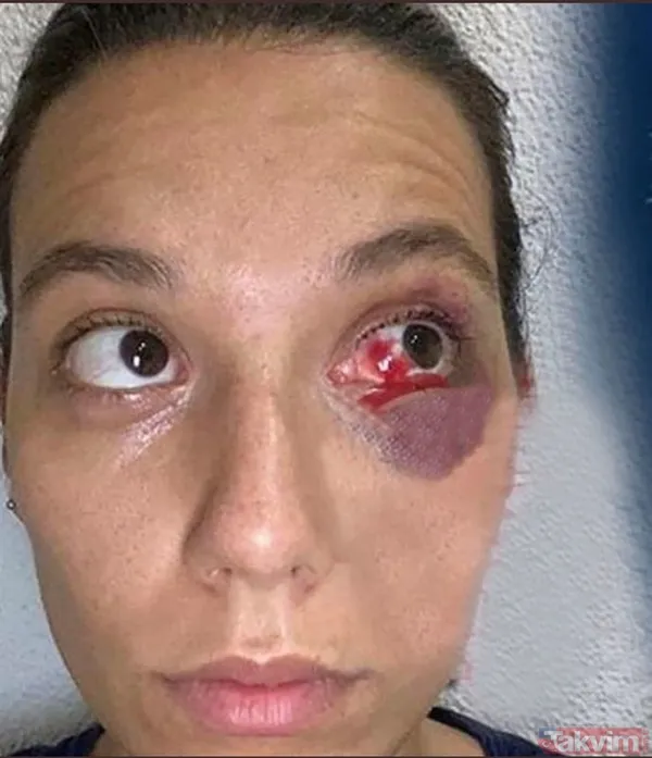 Ozan Güven'den şiddet gören Deniz Bulutsuz'un yeni görüntüleri ortaya çıktı! 'Bu nasıl vicdansızlık!' - 14