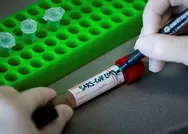 Son dakika: Dünyayı umutlandıran haber! Koronavirüsün zayıf noktası bulundu!