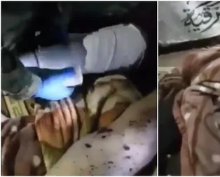 Mehmetçikten yaralı teröriste yardım eli