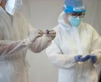 İtalya’daki koronavirüs testlerinde Türk mühendislerin imzası olan yapay zeka kullanılıyor