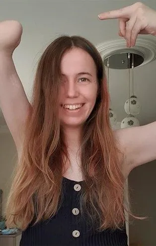 26 yıl önce yanlış iğneyle kolunu kaybeden Ayşen Başaran: Artık hastanelere korkmadan gidiyorum