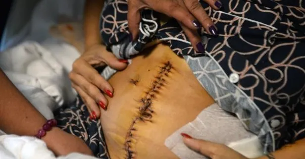 Adana’da eski sevgili dehşeti! Midesinin yüzde 30’u alındı 135 dikiş atıldı