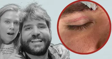 Seksenler dizisinin yıldızı darp edilmişti! Ceyhun Fersoyun eşi Begüm Öner kabus dolu geceyi anlatırken gözyaşlarına boğuldu