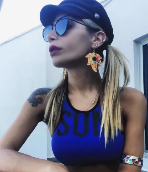 İrem Derici'nin son durumu nasıl?-10