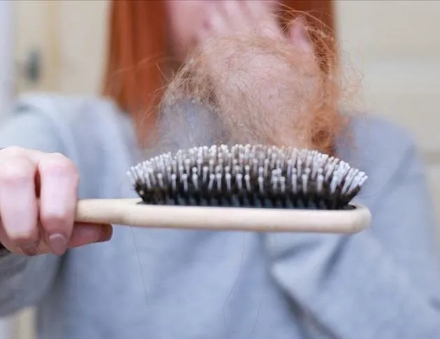 Demir eksikliği saç döker