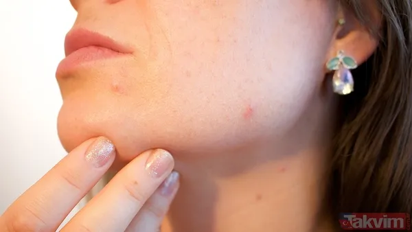 Pütür pütür cilt tarih oluyor: Kış yüzü sendromuna kesin çözüm - 6